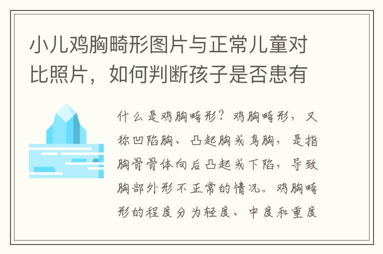 小儿鸡胸畸形图片与正常儿童对比照片，如何判断孩子是否患有鸡胸畸形？